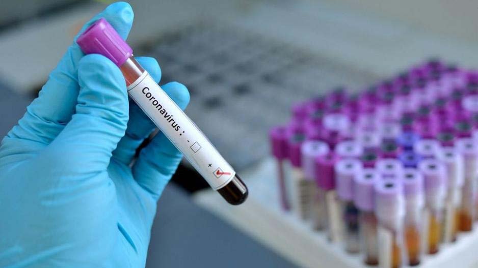 Coronavirus: Finance ministry seeking €2.69m to cover cost of tests