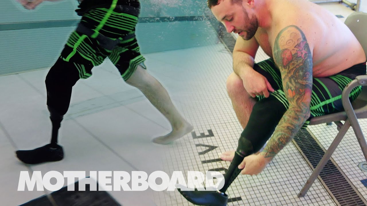 image Reclaiming mobility and athletic freedom with a prosthesis