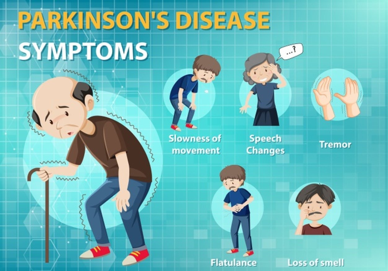 image Israeli researchers find major cause of Parkinson&#8217;s