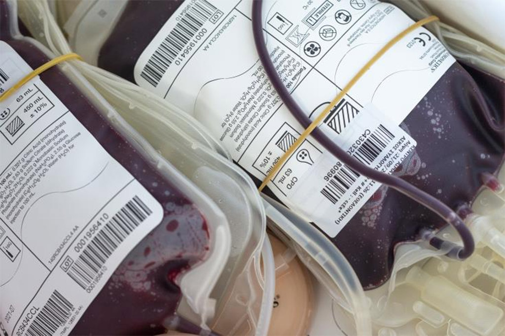 image Nearly one in ten Cypriots is a blood donor