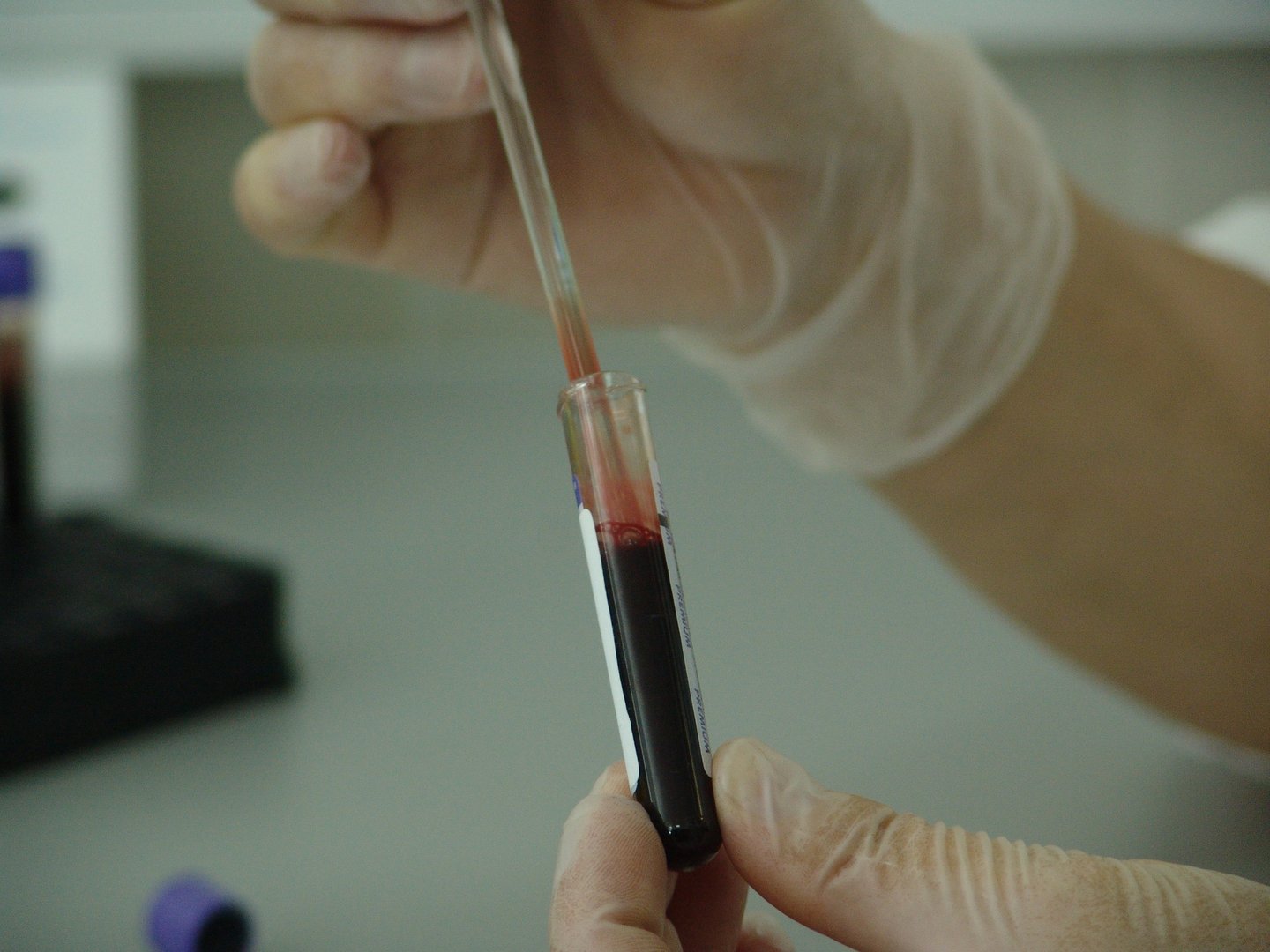 image Early cancer detection test could be a game-changer