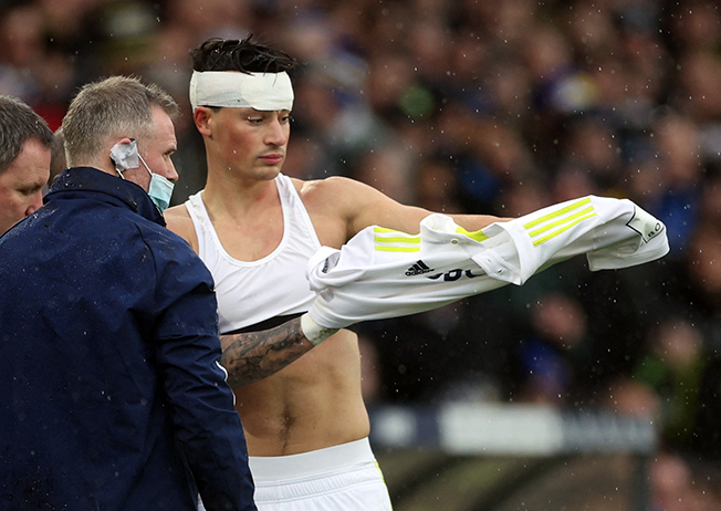 image Premier League reputation ‘on the line’ over head injuries