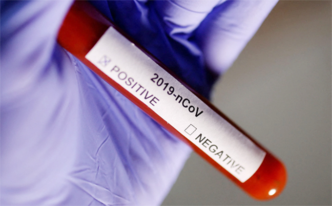 image British trial deliberately infecting young adults with Covid safe