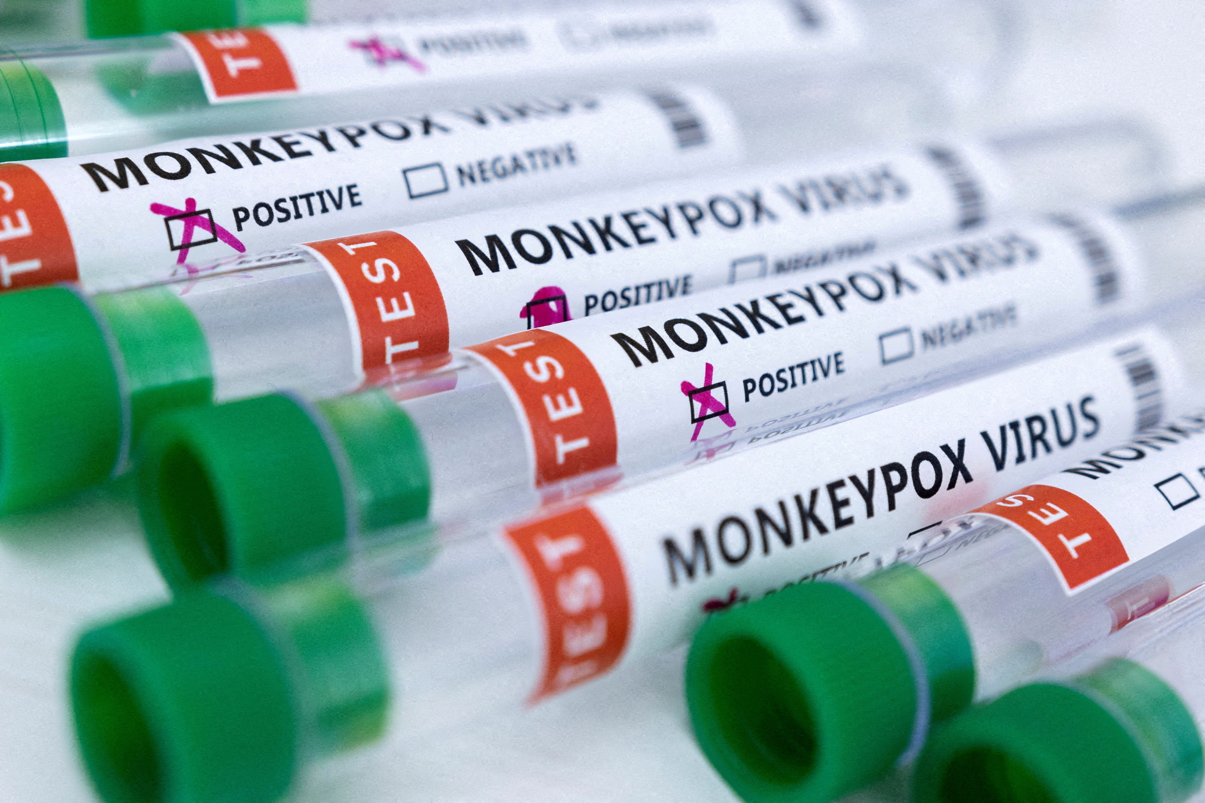 image Health Ministry: Monkeypox vaccines to arrive Saturday (Updated)