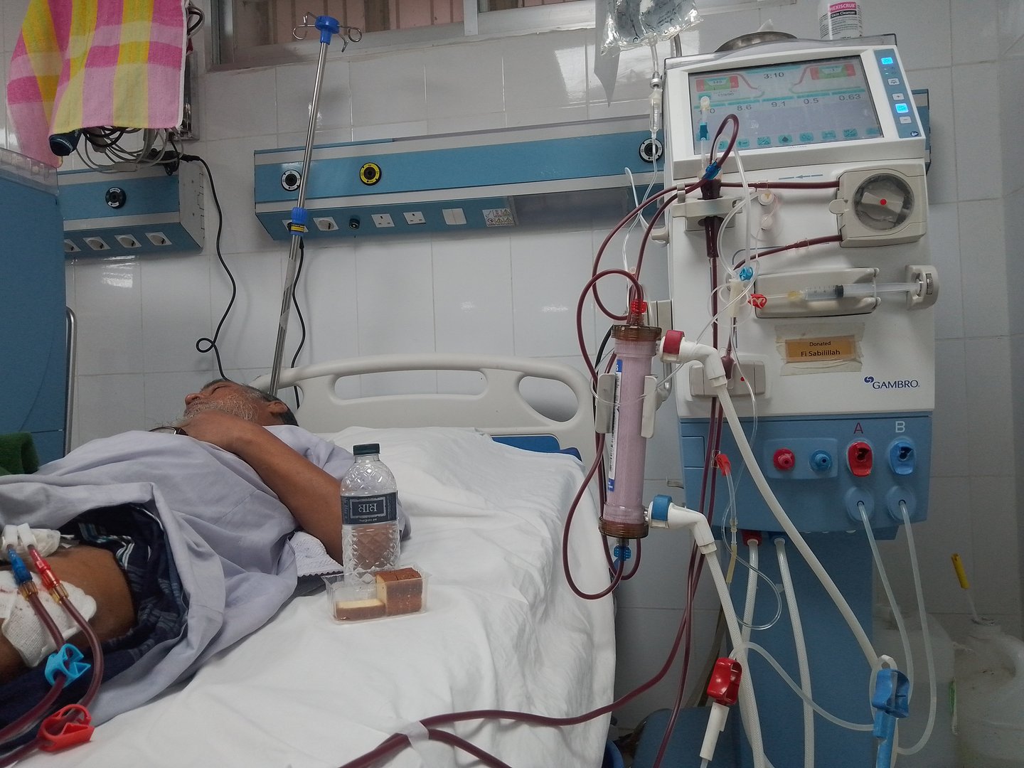 image Number of Cypriots undergoing dialysis more than doubles