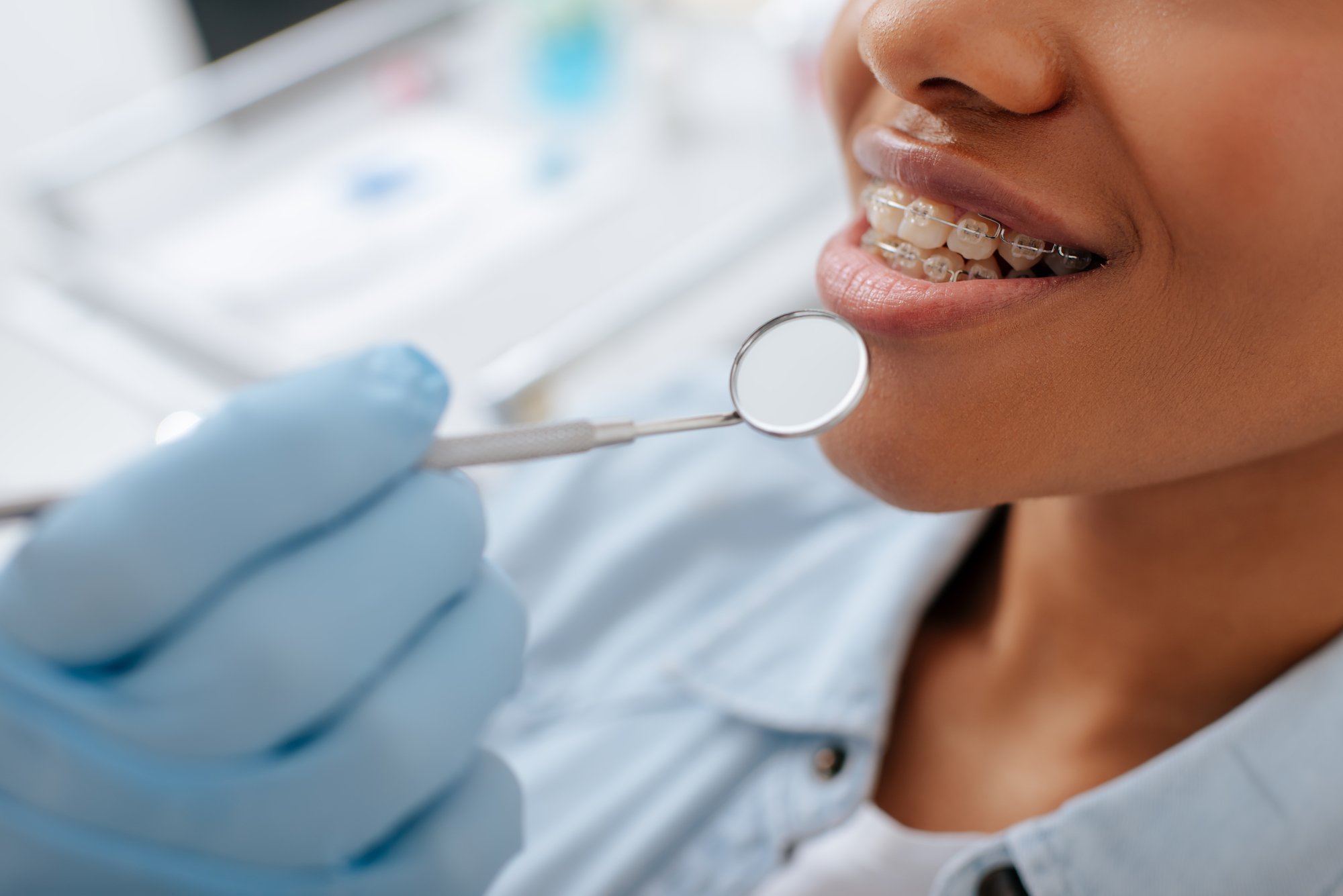 SecureDental PPO Plans: Coverage, costs, and benefits explained