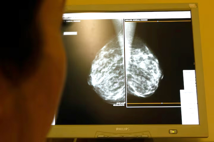 Cyprus-led team makes breast, ovarian cancer breakthrough