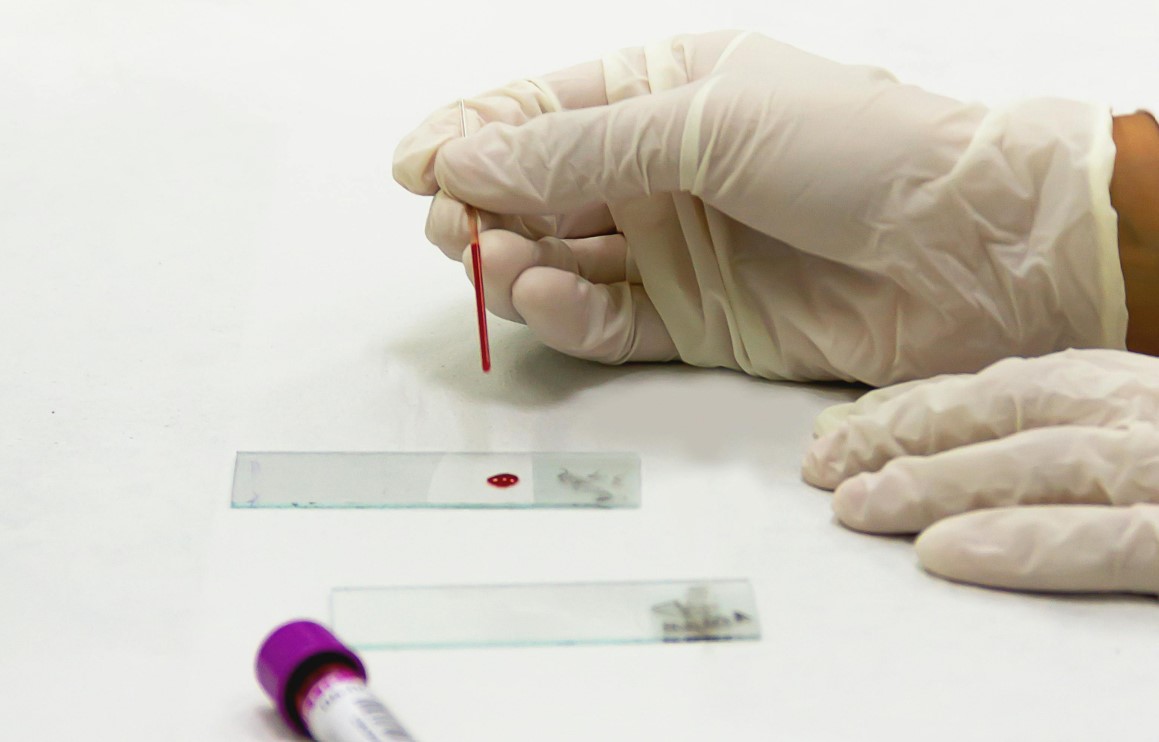 cover A simple blood test could change how Alzheimer’s is diagnosed
