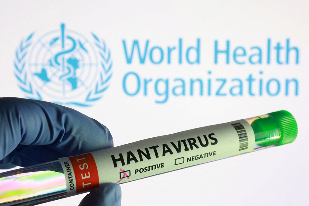 cover New hantavirus case suspected on remote island as contact tracing continues