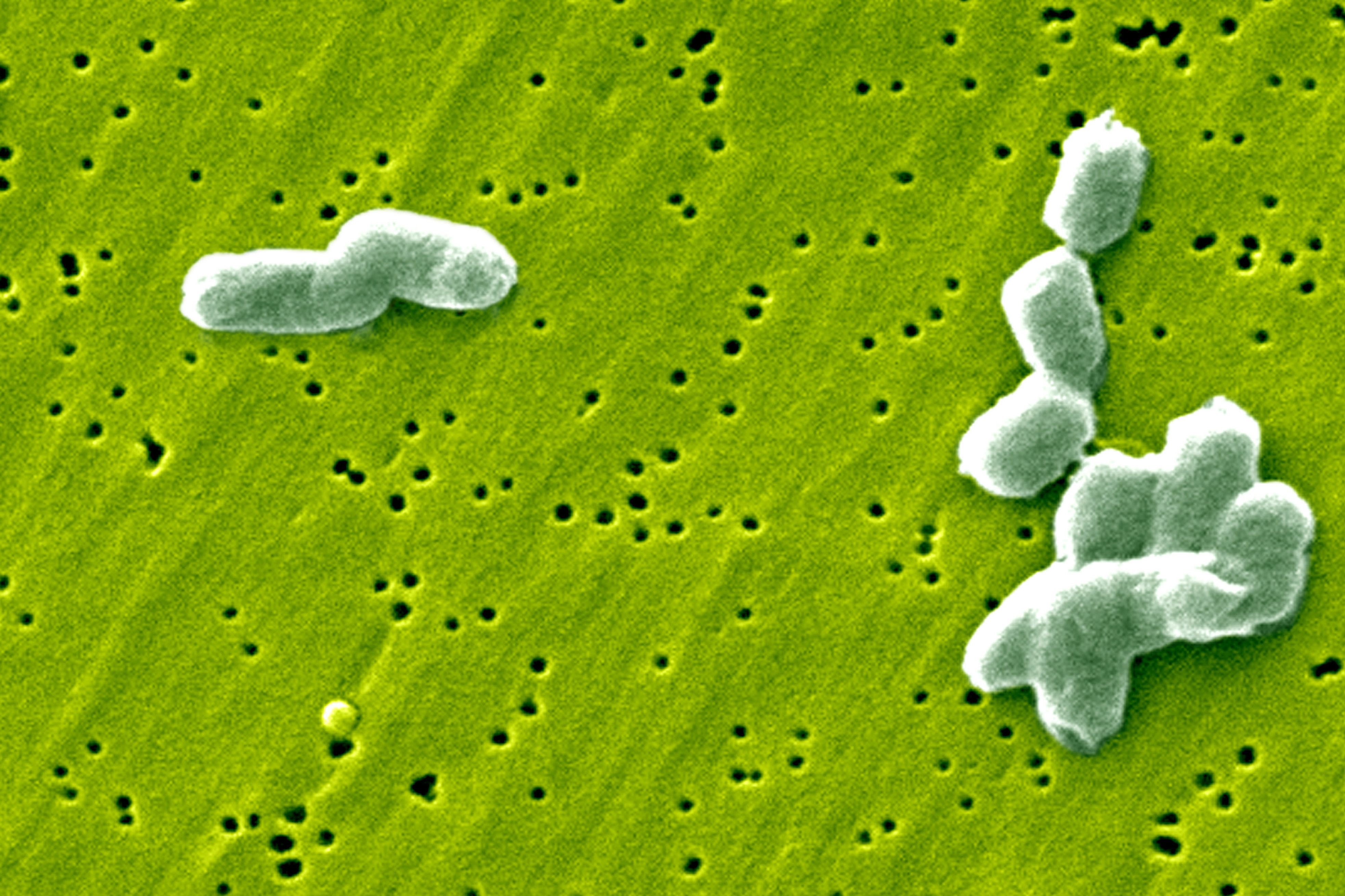 image Record salmonella outbreak in Belgium infects at least 306