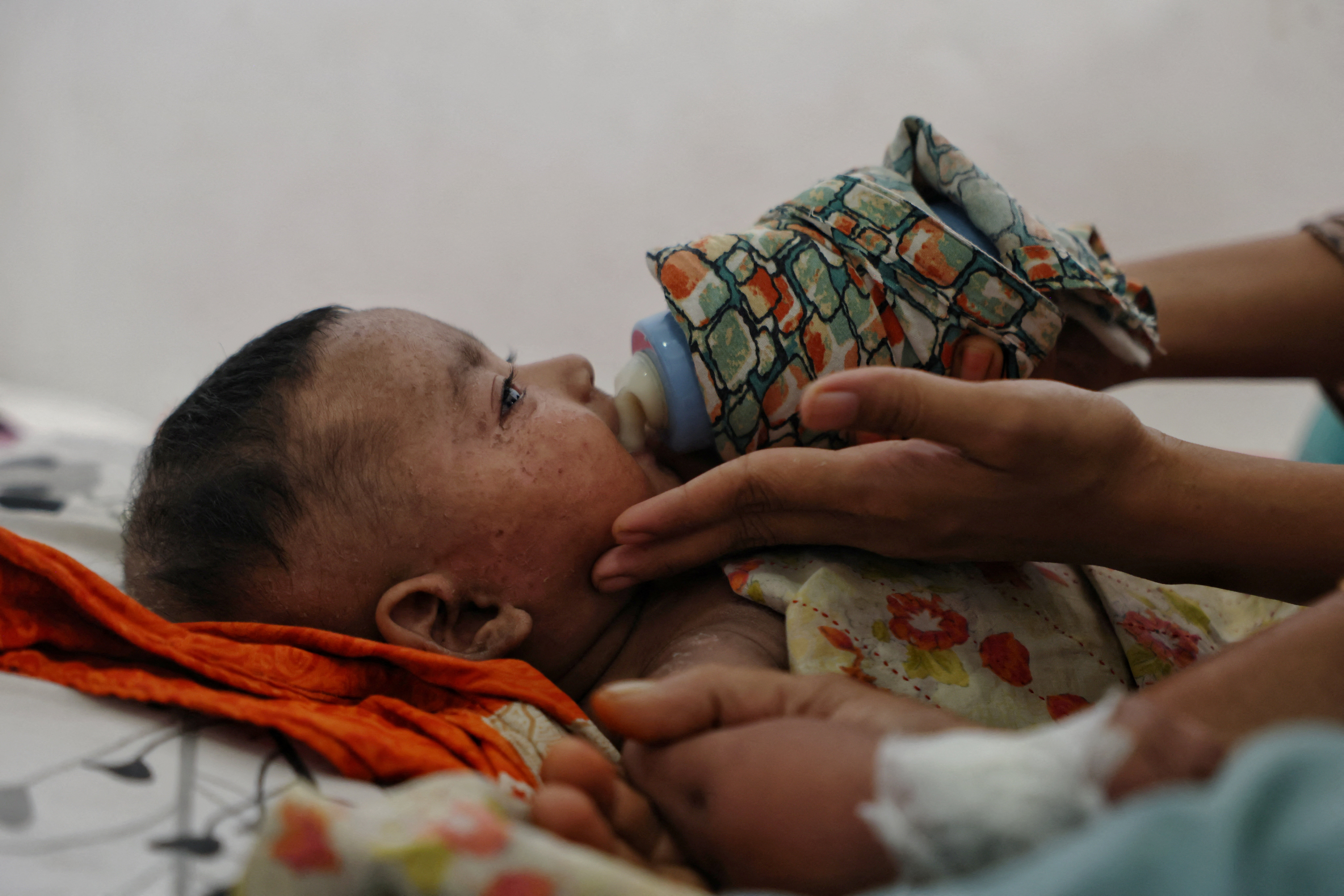 cover Gates says vaccine hesitancy has put measles eradication out of reach
